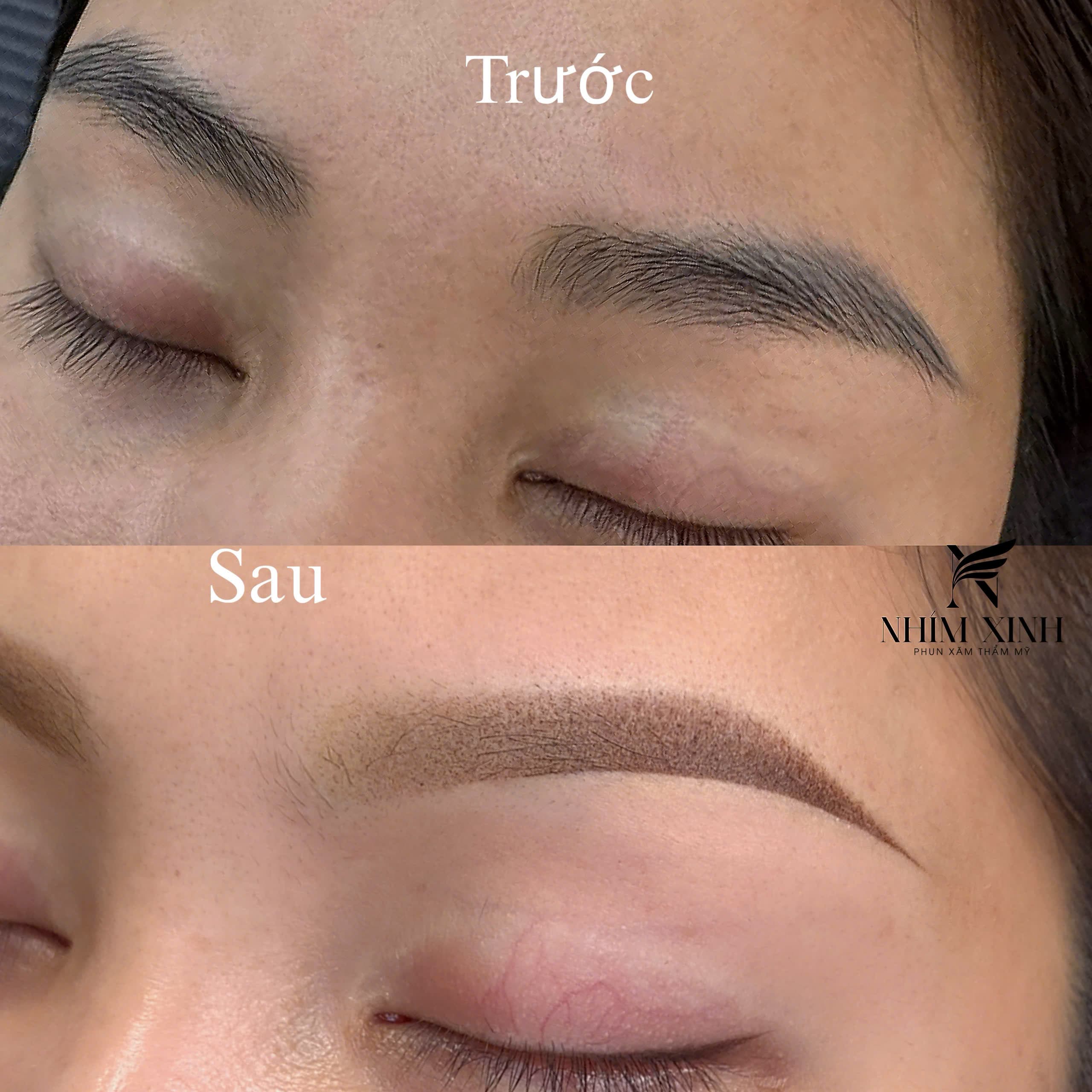 Phun mày — trước & sau