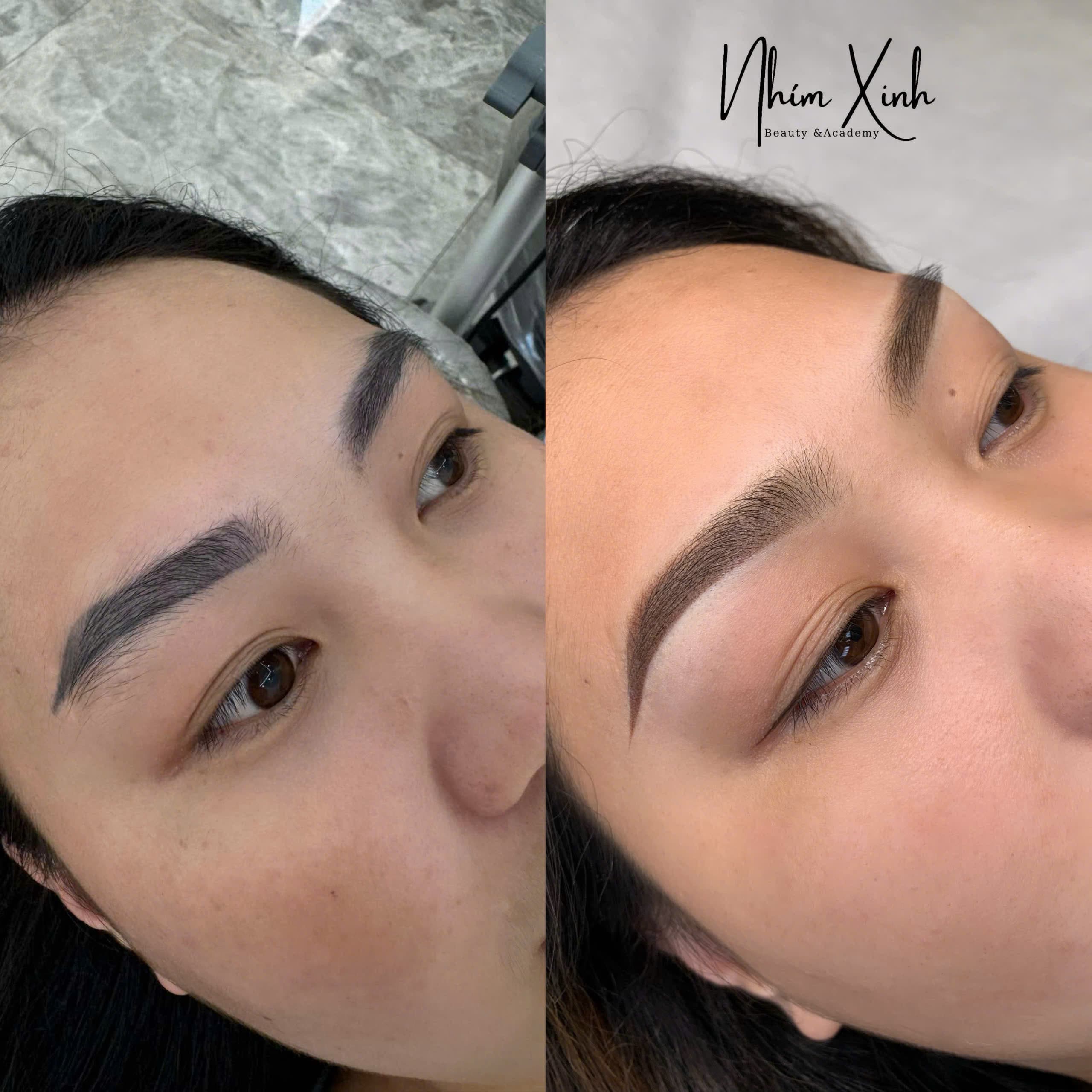Chân mày — trước & sau