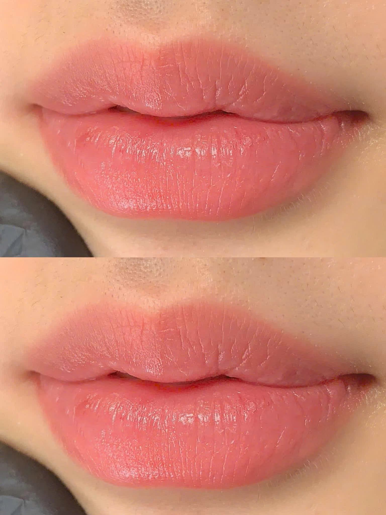 Phun môi — trước & sau